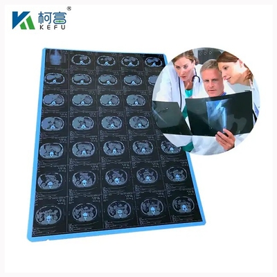 Diagnosi accurata e rapida con film radiografico medico ad alta risoluzione