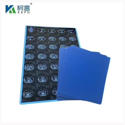 Radiologia PET Dry Inkjet Blue Medical Film 8x10 10x12 11x14 14x17 Inch Medical Orthopedic X Ray Films