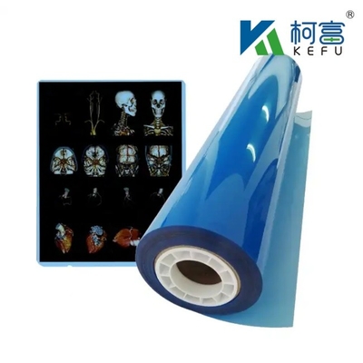 Blu Medicale Raggi X Film asciutto Ospedale CT Immagine medica Inkjet impermeabile