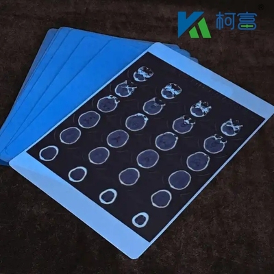 Blu Medicale Raggi X Film asciutto Ospedale CT Immagine medica Inkjet impermeabile