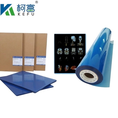 Dimensioni personalizzate 35x43 Inkjet Blu Medical X Ray Film Per Epson A4 PET Dry Blue Medical Laser Xray