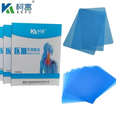 Dimensioni personalizzate Film a raggi X Medici a getto d'inchiostro Blu per Epson A4 A3 PET Laser Medici a raggi X Blu Seco In vendita