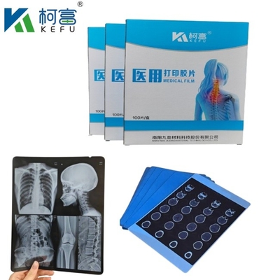 Dimensioni personalizzate Film a raggi X Medici a getto d'inchiostro Blu per Epson A4 A3 PET Laser Medici a raggi X Blu Seco In vendita