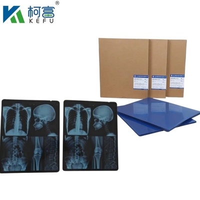 Dimensioni personalizzate Film a raggi X Medici a getto d'inchiostro Blu per Epson A4 A3 PET Laser Medici a raggi X Blu Seco In vendita