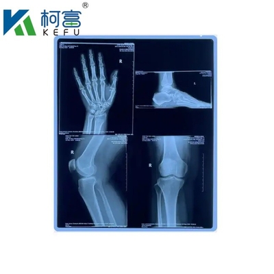 Immagini mediche a base di PET a raggi X a tinta blu/film laser personalizzate per cliniche e ospedali