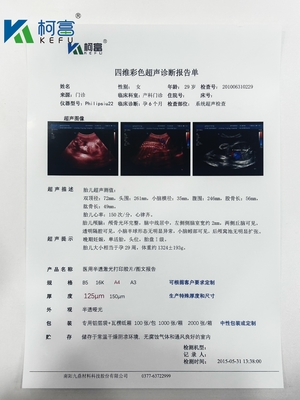 Film asciutto medico trasparente a getto d'inchiostro Film bianco a raggi X Per apparecchiature radiologiche per la TC DR MRI