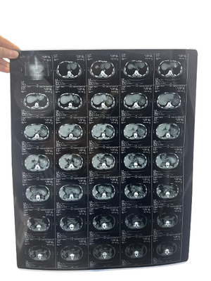 Min Densità 0,28D Film a raggi X per risultati diagnostici accurati e dettagliati