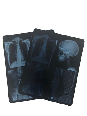 Film per animali da compagnia a getto d'inchiostro blu impermeabile 8*10 10*12 10*14 pollici PET a raggi X Blu Sheet Film medico per la stampa digitale