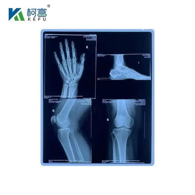 Film laser medico 16x21in 0.17mm di lunga durata e bassa manutenzione che mantiene la qualità dell'immagine per lunghi periodi con un mantenimento minimo