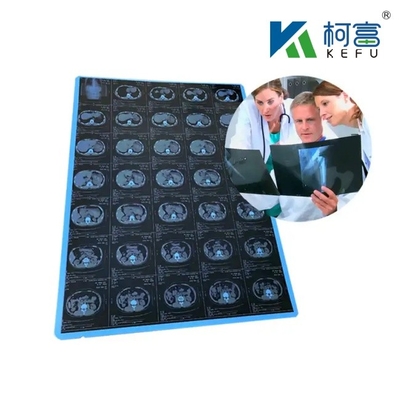 125 Micron Semi - Laser Bianco Trasparente Medicale X - Ray PET Film di Plastica Progettati per eccellere in Medicina