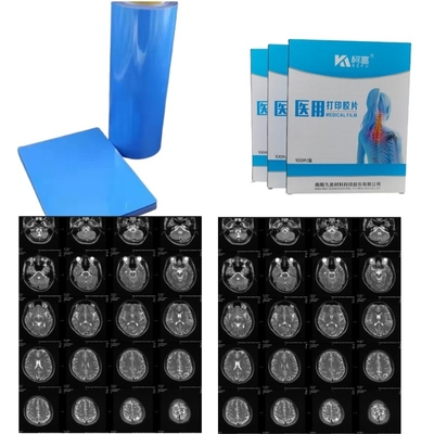 Immagine medica PET secca a getto d'inchiostro Laser Film medico a raggi X 14x17 pollici