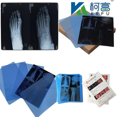 14*17 pollici di pellicola di scansione a secco medica a raggi X/CT/DR per stampante laser a raggi X e apparecchiature di stampante di immagini termiche