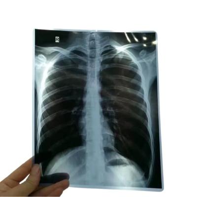 14*17 pollici di pellicola di scansione a secco medica a raggi X/CT/DR per stampante laser a raggi X e apparecchiature di stampante di immagini termiche