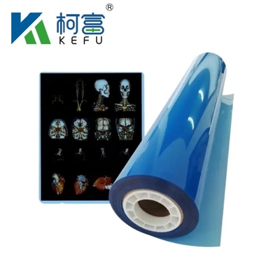 Dimensioni personalizzate Blu Bianco Inkjet Film Medicale a raggi X Per Stampanti a getto d'inchiostro in fogli