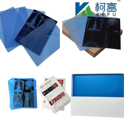 Dimensioni personalizzate Blu Bianco Inkjet Film Medicale a raggi X Per Stampanti a getto d'inchiostro in fogli