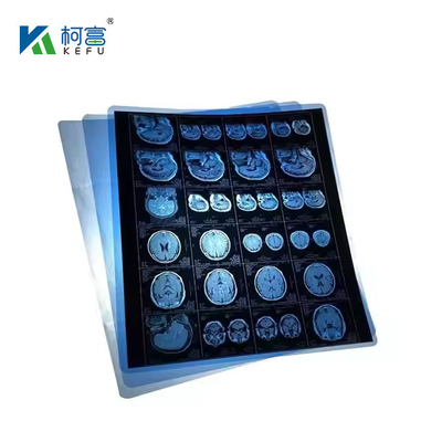 Film medico a getto d'inchiostro trasparente bianco blu / laser Film a raggi X