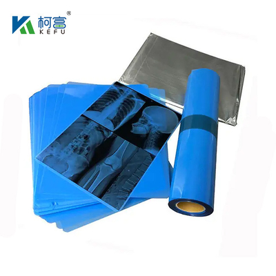175mic 215mic High Definition Medical Imaging CT DR Inkjet Blue Film Medical X-ray Pet Film A3 A4 Film di stampa blu trasparente