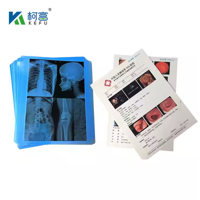 Film laser medico con alta precisione e fedeltà del colore 14x18in 0.16mm per immagini diagnostiche reali