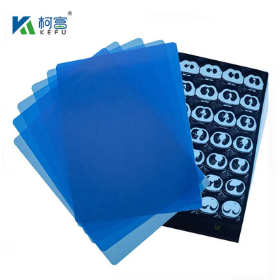 Immagine medica CT ospedaliera Inkjet impermeabile Blu Medicale X-ray Film asciutto