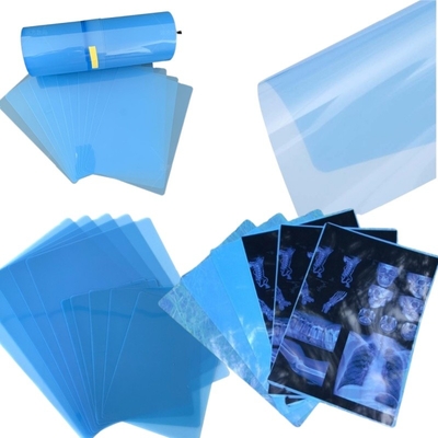 CT Scanner Radiografia secca A3 / A4 Inchiostro medico Jet Film Blu Film PET a raggi X