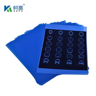 Film blu a getto d'inchiostro medico a raggi X 210micron CT DR Film A4 8x10 Fogli o rotoli per supporti di stampa a getto d'inchiostro medico