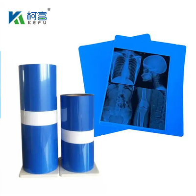 Accuratezza diagnostica Film radiografico medico con riproduzione dei colori ad alta fedeltà