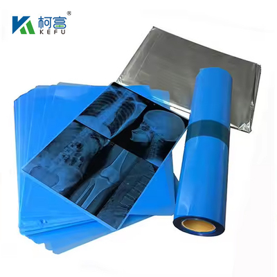 High-Definition Medical X-Ray Film per immagini accurate e chiare nei mercati nazionali e internazionali.
