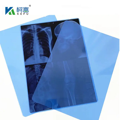Film laser medico facile da maneggiare e flessibile, 13x17 pollici, 0,15 mm, con una superficie liscia e resistente alla piegatura