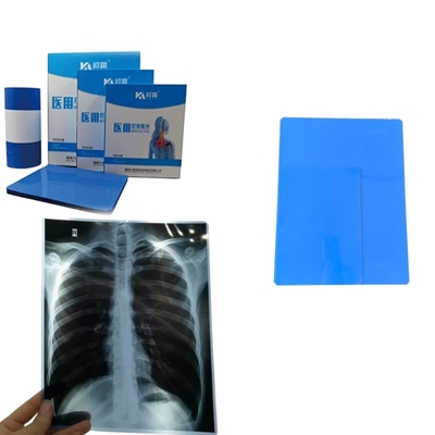 Fogli di formato A4 Film a getto d'inchiostro blu a raggi X per immagini mediche Stampa a raggi X CT CR DR MTR PET