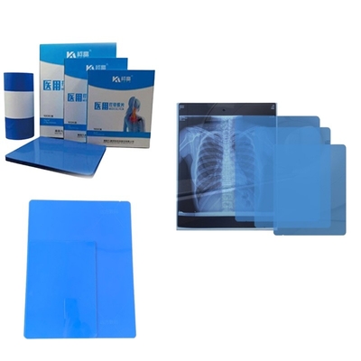 Esemplare gratuito di stampa a tinta a raggi X con pellicola stampata da stampante per radiologia diagnostica medica 8*10 stampante