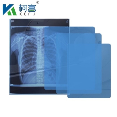 8x10 10x12 10x14 14x17 Inch Medical Dry DIHL Film Laser Xray Film Per Cliniche E Ospedali