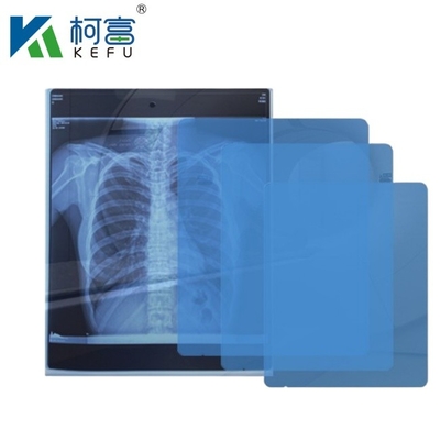 Imaging medico ad alta definizione CT DR Inkjet Medical X-ray Pet Film 175mic 215mic Film di stampa blu trasparente