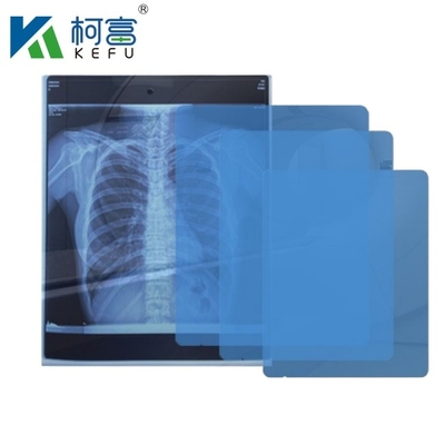 Dimensioni personalizzate Film medico a raggi X Blu Film medico sensibile a raggi X Film medico a getto d'inchiostro