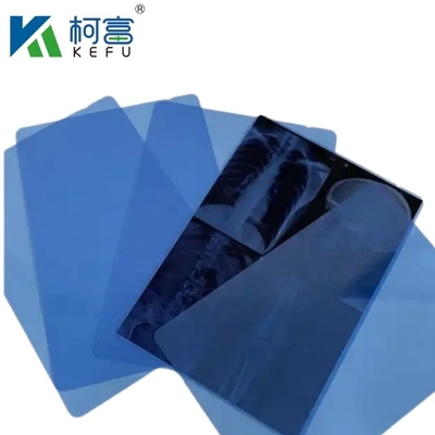 Film laser medico di dimensioni compatte e leggere, 4x6in, 0,09 mm, per una facile integrazione con apparecchiature a raggi X in miniatura