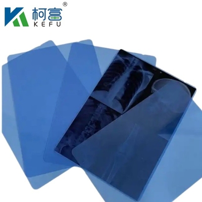 Stampa termica laser Film a raggi X Film medicale blu a getto d'inchiostro a raggi X semitransparente