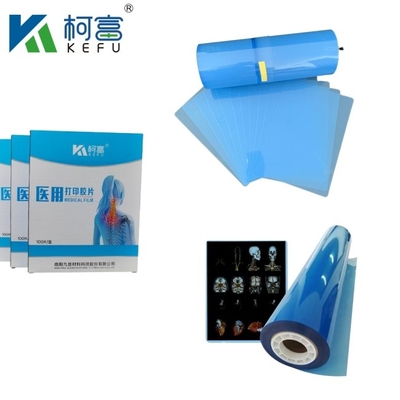 Stampa termica laser Film a raggi X Film medicale blu a getto d'inchiostro a raggi X semitransparente