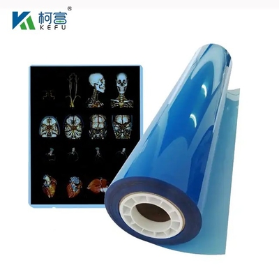 Film laser medico ad alta definizione e ampio raggio 17x22in 0.17mm per esami medici dettagliati e vividi