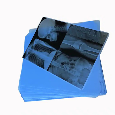 Scopri 125 Micron Semi - Laser Bianco Trasparente Medicale X - Ray PET Film di Plastica Per Applicazioni Mediche