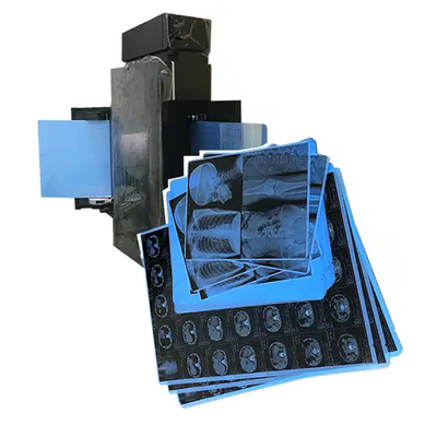 Scopri 125 Micron Semi - Laser Bianco Trasparente Medicale X - Ray PET Film di Plastica Per Applicazioni Mediche