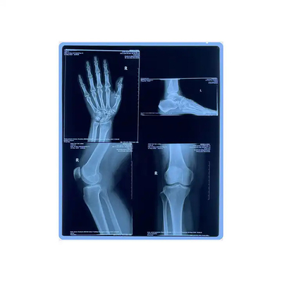 11*14 Film a raggi X blu medico per la stampa laser