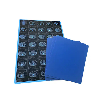 11*14 Film a raggi X blu medico per la stampa laser