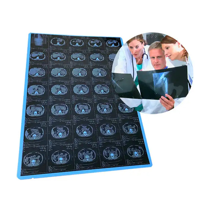 11*14 Film a raggi X blu medico per la stampa laser