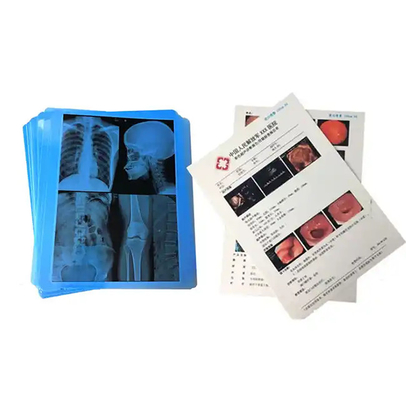 Disponibile una pellicola medica blu a raggi X prodotta professionalmente per la stampa laser