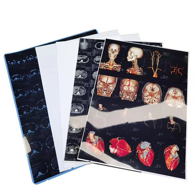 Film a raggi X medici ad alta risoluzione blu bianco con finitura superficiale lucida