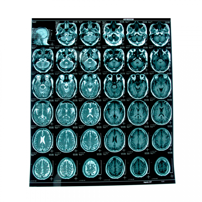 Film medico a raggi X a getto d'inchiostro blu Film medico a secco A4 A3 fogli o rotoli 0