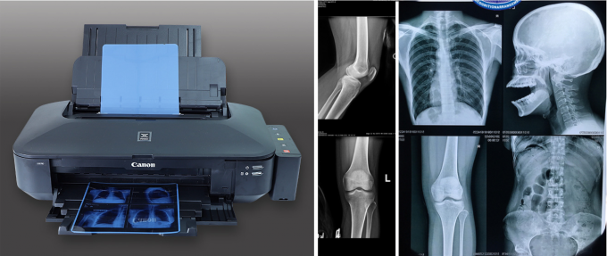 Pellicola medica a raggi X blu per stampanti a getto d'inchiostro ad alta nitidezza e bassa nebbia 5